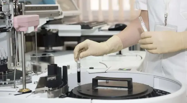 Ręka w rękawiczce trzyma probówkę z ciemnym płynem nad aparaturą laboratoryjną.
