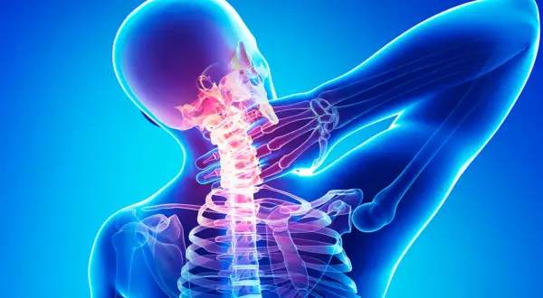 Menschlicher Nacken mit leuchtender Wirbelsäule, die auf Osteochondrosis intervertebralis hinweist.