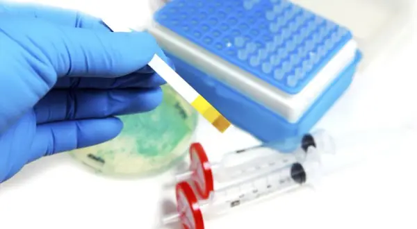 Rękawiczka trzyma pasek testowy, który może pomóc w diagnozowaniu kwasicy mleczanowej. W tle widać sprzęt laboratoryjny.