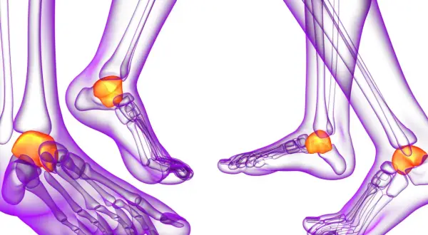 Anatomie du pied : vue latérale des os de la cheville, mettant en évidence le talus, un os clé de la malléole.