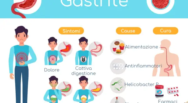 Illustrazione sulla gastrite cronica: sintomi (dolore, cattiva digestione, nausea, bruciore), cause (alimentazione, antinfiammatori, Helicobacter P, alcool) e cura (farmaci, dieta sana).