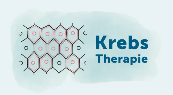Abstrakte Darstellung von Zellen, die auf eine Krebsbehandlung hindeuten.
