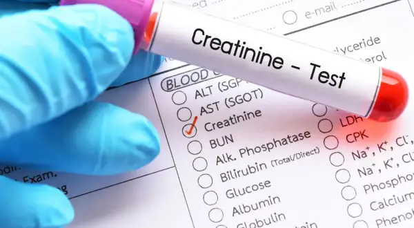 Ręka w niebieskiej rękawiczce trzyma probówkę z napisem "Creatinine - Test". Obok znajduje się formularz z zaznaczoną opcją "Creatinine", wskazującą na badanie kreatyniny w moczu.
