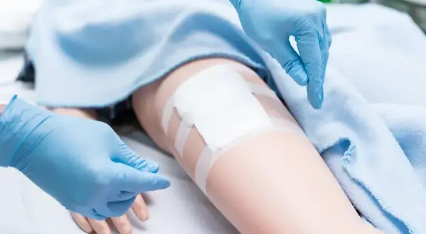Ręce w niebieskich rękawiczkach zmieniają opatrunek na nodze, pokazując prawidłową pielęgnację rany pooperacyjnej w domu.