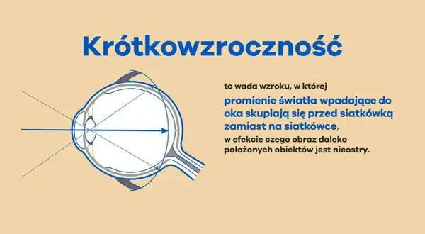 Krótkowzroczność: Objawy, przyczyny i skuteczne metody korekcji