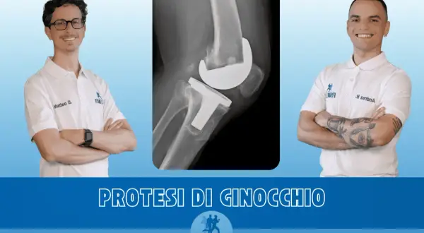 Due medici sorridono accanto a una radiografia di un ginocchio protesico, simbolo di recupero e miglioramento dei movimenti del polso.