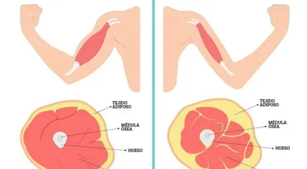 Cómo prevenir la pérdida de masa muscular y mejorar tu calidad de vida