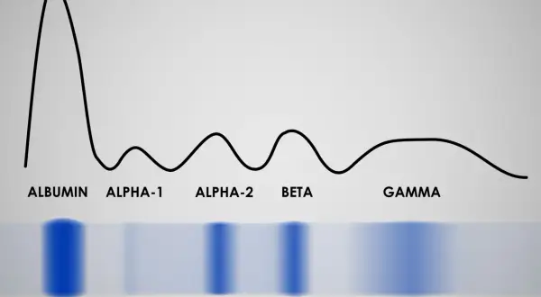 Wykres proteinogramu z frakcjami: albuminy, alfa-1, alfa-2, beta i gamma. Widoczne pasma elektroforetyczne.