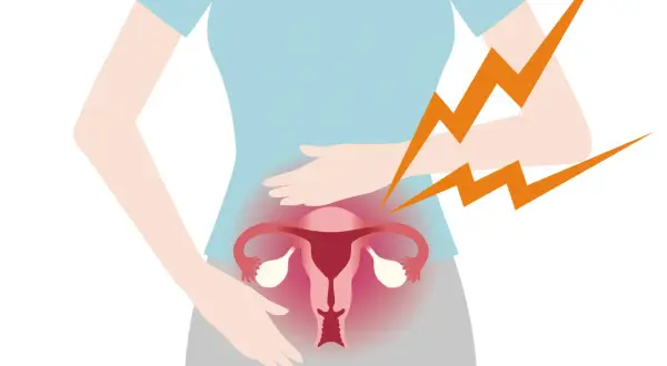 Illustration av en gravid kvinna som håller sig om magen. Hon upplever ilningar i underlivet, symboliserat av blixtar.