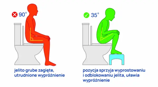 Tenesmus i parcie na stolec: Jak odzyskać komfort? Przyczyny i leczenie