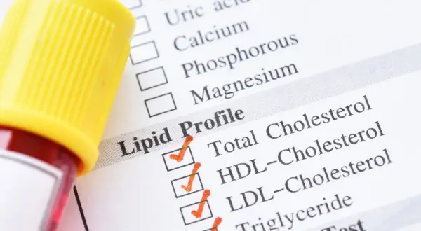 Próbka krwi i formularz Lipid Profile. Wyniki badania pomogą ustalić, co podwyższa cholesterol.