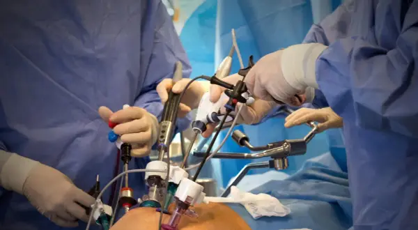 Chirurgen führen eine minimalinvasive Prostata-OP durch. Hände in Handschuhen bedienen feine Instrumente, die durch kleine Schnitte eingeführt werden.