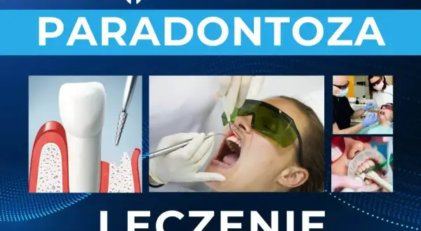 Grafika przedstawia leczenie paradontozy: ilustrację zęba z ubytkami kostnymi, zabieg laserowy i stomatologiczne procedury.