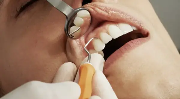 Ile trwa wizyta u dentysty? Czas zabiegów od A do Z
