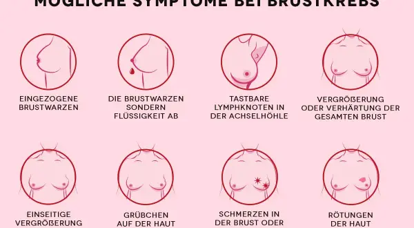 Grafik zeigt mögliche Symptome von Brustkrebs, darunter tastbare Lymphknoten in der Achselhöhle und eine Vergrößerung oder Verhärtung der Brust.