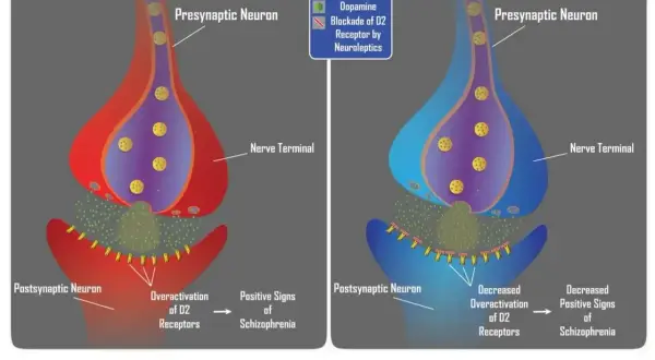 Schemat działania neuroleptyków: schizofrenia (nadaktywne receptory D2) vs. typowe neuroleptyki (blokada receptorów D2).