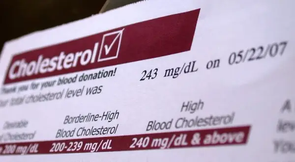 Jak oznaczony jest cholesterol na wynikach? Zrozum swoje wyniki zdrowotne