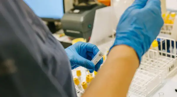 Laborant hanterar provrör i laboratoriemiljö, en del av forskningen kring anhedoni behandling.