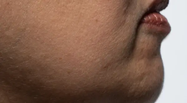 Nahaufnahme der Haut mit feinen Härchen und Lippen. Die alpha arbutin wirkung kann hier zu einem ebenmäßigeren Hautbild beitragen.