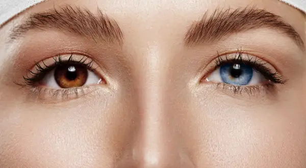 Oczy z różnymi kolorami tęczówek – jedno brązowe, drugie niebieskie. To piękny przykład heterochromii częściowej.