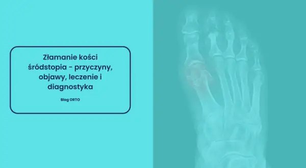 Rentgen stopy z widocznym złamaniem kości śródstopia.