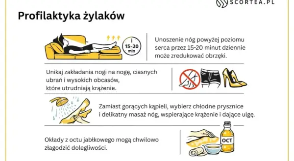 Jak zapobiec żylakom? Pełny przewodnik do zdrowych nóg!