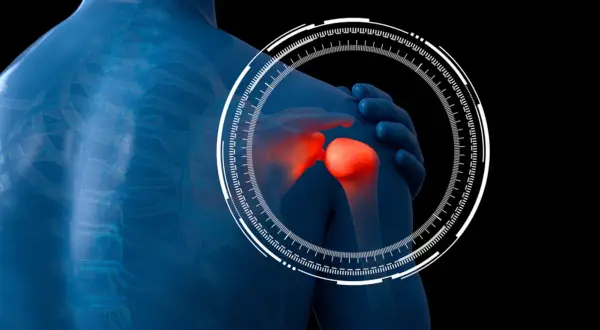 Focus su esercizi per artrosi spalla: immagine 3D di spalla infiammata, con cerchio tecnologico.