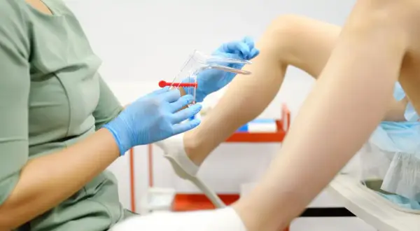 Lekarz w rękawiczkach przygotowuje wziernik do badania. To ważny krok w diagnostyce, np. gdy podejrzewasz grzybica pochwy objawy.
