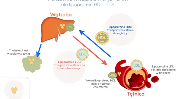 Ilustracja pokazuje transport cholesterolu, wyjaśniając, co to jest dyslipidemia. HDL transportuje cholesterol do wątroby, a LDL do tkanek, odkładając go w tętnicach.