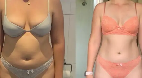 Vorher/Nachher-Vergleich einer Frau mit endomorphem Körperbau, die durch Training und Ernährung ihre Figur verändert hat.