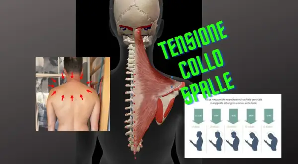Anatomia muscolare e scheletrica del collo e delle spalle, con frecce rosse che indicano punti di dolore e un grafico sulla tensione muscolare collo.