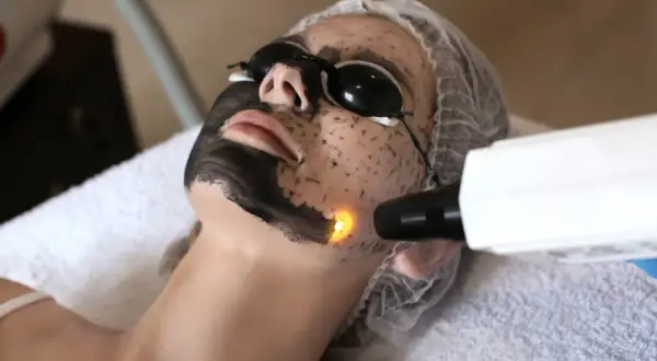 Kobieta z maską węglową na twarzy przechodzi zabieg laserem.