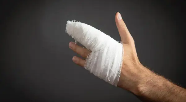 Dłoń z zabandażowanym kciukiem, który wygląda na wybity. Biały opatrunek obejmuje palec i część dłoni.