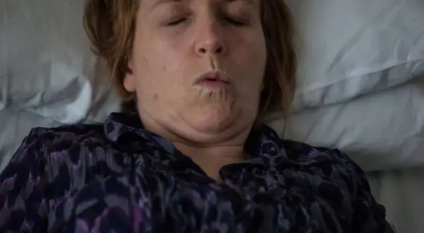 Donna con occhi chiusi e bocca socchiusa, forse a causa di una disestesia neurologica. Indossa una camicetta viola.
