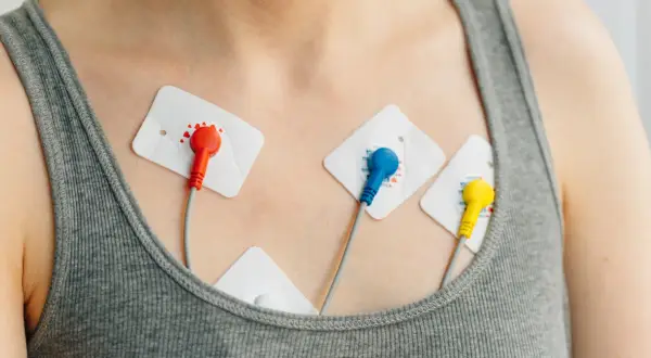Elektrody EKG na klatce piersiowej, monitorujące pracę serca w celu wykrycia arytmii.