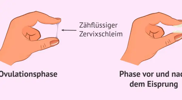 Hände zeigen Zervixschleim: zähflüssig in der Ovulationsphase, klumpig davor/danach. Ein Zeichen für Fruchtbarkeit bei Frauen.