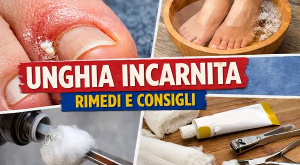 Unghia incarnita: rimedi della nonna e consigli pratici. Pediluvio, medicazioni e strumenti per alleviare il dolore.