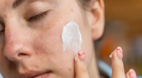 Kwas azelainowy i retinol to składniki aktywne w pielęgnacji skóry. Krem nakładany na twarz, widoczne piegi i zaczerwienienia.