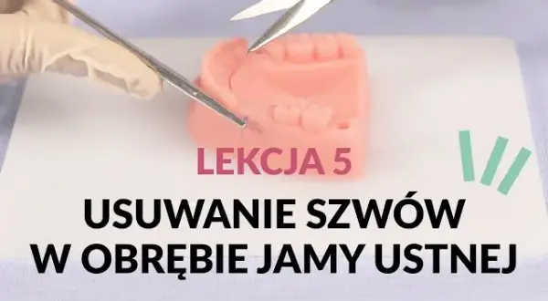 Czy ściąganie szwów z dziąsła boli? Oto co musisz wiedzieć