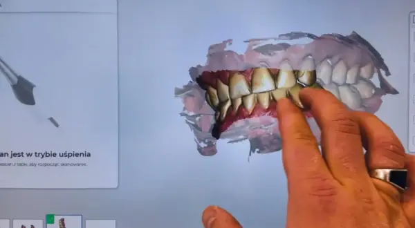 Co dentysta widzi? Więcej niż myślisz - poznaj prawdę