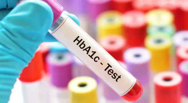 Rękawiczka trzyma probówkę z oznaczeniem HbA1c - Test. Tło to wiele kolorowych probówek. Sprawdź, jaka jest hemoglobina glikowana cena.