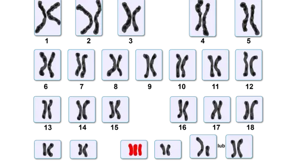 Zestawienie różnych par chromosomów, w tym jedna nieprawidłowa triada.