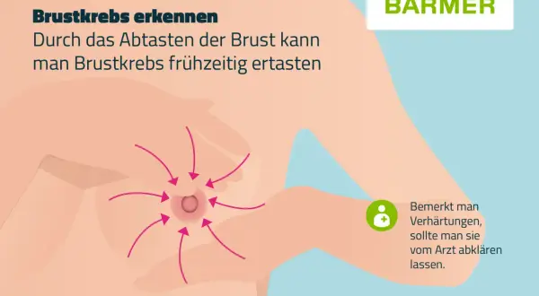 Brustkrebs erkennen: Pfeile zeigen auf eine Brustwarze, wo sich Knoten in der Brust befinden könnten. Bei Verhärtungen Arzt aufsuchen.