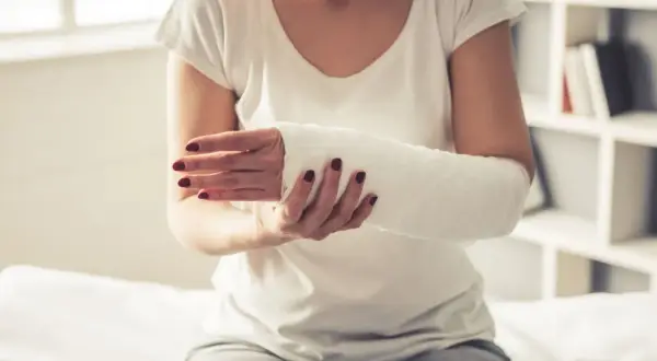 Kobieta z ręką w gipsie na złamania. Biały opatrunek obejmuje przedramię i dłoń, zapewniając stabilizację po urazie.