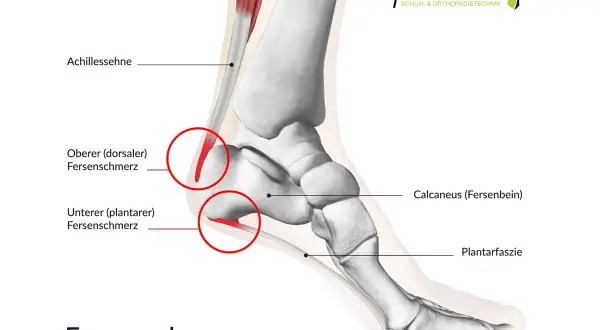 Anatomische Darstellung des Fußes mit Fokus auf Fersenschmerzen. Die Achillessehne und der Wadenmuskel sind sichtbar. Rote Kreise markieren Schmerzbereiche an der Achillessehne und der Plantarfaszie.