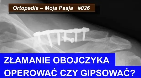 Złamanie kości: Ortopeda czy chirurg? Kto naprawdę Ci pomoże?