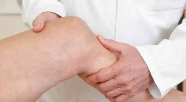 Arzt untersucht Knie. Mögliche Symptome für ein Ewing-Sarkom werden abgetastet.