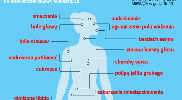 Akromegalia: zmęczenie, bóle głowy, stawów, nadciśnienie, problemy ze wzrokiem, bezdech senny, cukrzyca. Zwróć uwagę na te objawy!