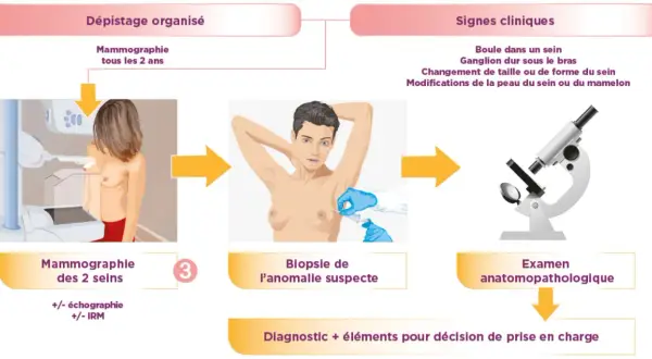 Un examen anatomopathologique suit une biopsie, étape clé pour le diagnostic.