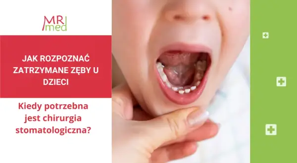Dziecko z otwartymi ustami, widoczne nieprawidłowe wyrzynanie się zębów stałych. Tekst informuje o zatrzymanych zębach u dzieci i chirurgii stomatologicznej.